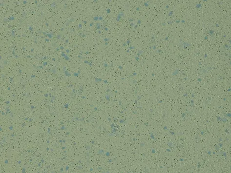 Altro Aquarius - Treefrog
