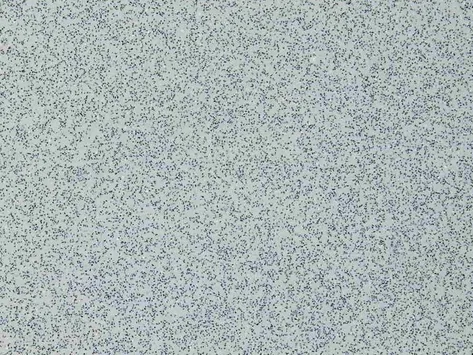 Altro Xpresslay - Cloud